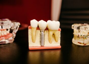 How Age Affects Dental Implant Eligibility