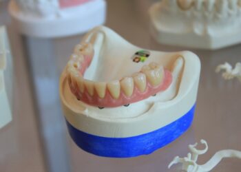 The Role of Periodontists in Maintaining Long-Term Oral Health
