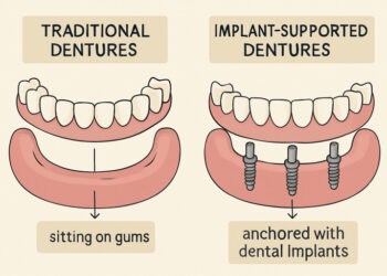 Are Denture Implants the Best Solution for Missing Teeth?